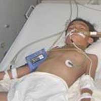 Sức khỏe đời sống - Bị chó cắn, 2 trẻ nguy kịch