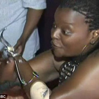 Thẩm mỹ viện - Bị cắt tứ chi vì độn mông