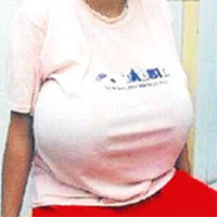 Phi thường - kỳ quặc - Khổ sở vì có bộ ngực to... ngoại cỡ