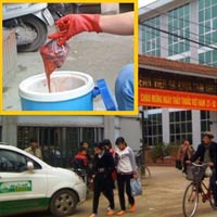 Sức khỏe đời sống - Kinh hoàng nhau thai bán như... thịt lợn