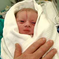 Sức khỏe đời sống - Mổ đẻ: Rạch mẹ, cắt nhầm phải con