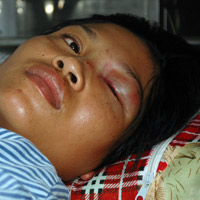 Tin tức trong ngày - CSGT bị tố "vụt" gậy vào mặt người đi đường