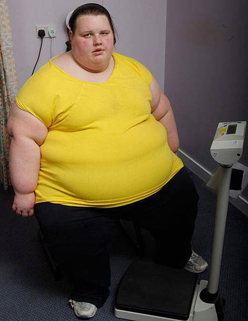 Thiếu nữ 19 tuổi nặng 400 kg - 1