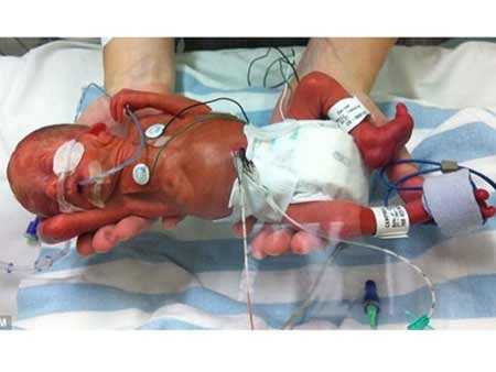 Bào thai chết trong bụng suốt 5 tuần - 2