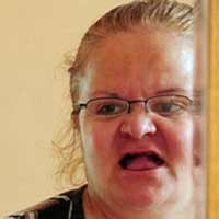 Sức khỏe đời sống - Mất sạch răng vì nha sĩ “dởm"