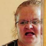 Mất sạch răng vì nha sĩ “dởm"