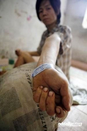 Hình ảnh ngày cuối đời của một con nghiện TQ - 8