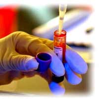 Sức khỏe đời sống - Xét nghiệm: Bước đột phá trong điều trị ung thư