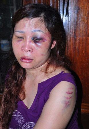 Nỗi đau bị chồng cũ hành hung vì đòi con - 2