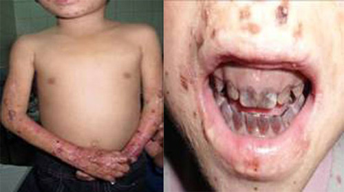 Bệnh "lạ" không chỉ có ở Quảng Ngãi - 2