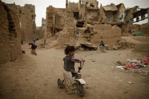 Những đứa trẻ teo tóp đáng thương ở Yemen - 11