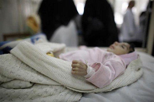 Những đứa trẻ teo tóp đáng thương ở Yemen - 12