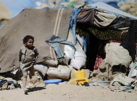 Những đứa trẻ teo tóp đáng thương ở Yemen - 7