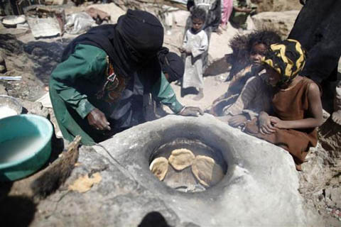 Những đứa trẻ teo tóp đáng thương ở Yemen - 8