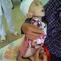 Tin tức trong ngày - Cháu bé tử vong vì chữa bỏng ở "lang vườn"