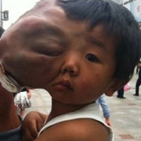 Phi thường - kỳ quặc - Xót xa cậu bé... "2 đầu"