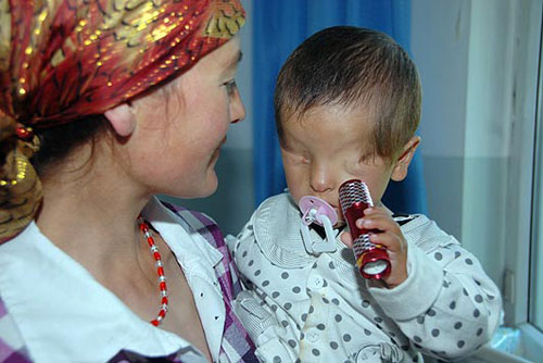 Trung Quốc: Cậu bé chào đời không có mắt - 1
