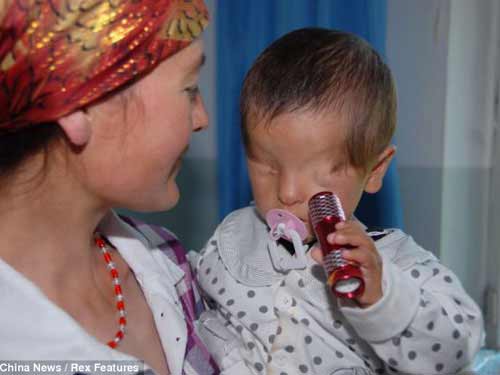 Cậu bé không có mắt từ lúc chào đời - 2