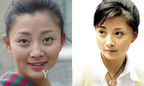 Soi xấu - đẹp trên gương mặt sao Hoa ngữ - 20