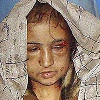 Tin tức trong ngày - Afghanistan: Cô dâu 14 tuổi bị ép bán dâm