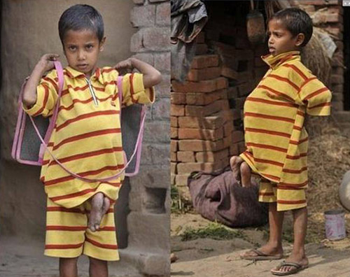 Những nụ cười đẹp nhất của nghị lực - 12