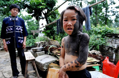 Những nụ cười đẹp nhất của nghị lực - 2