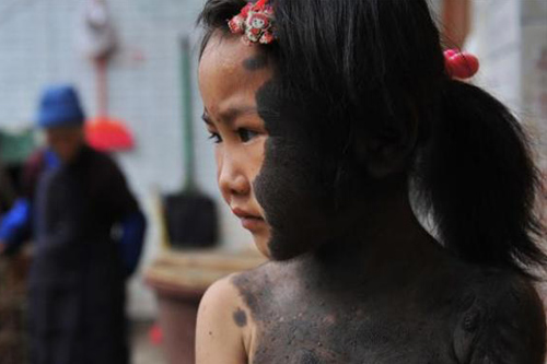 Những nụ cười đẹp nhất của nghị lực - 3