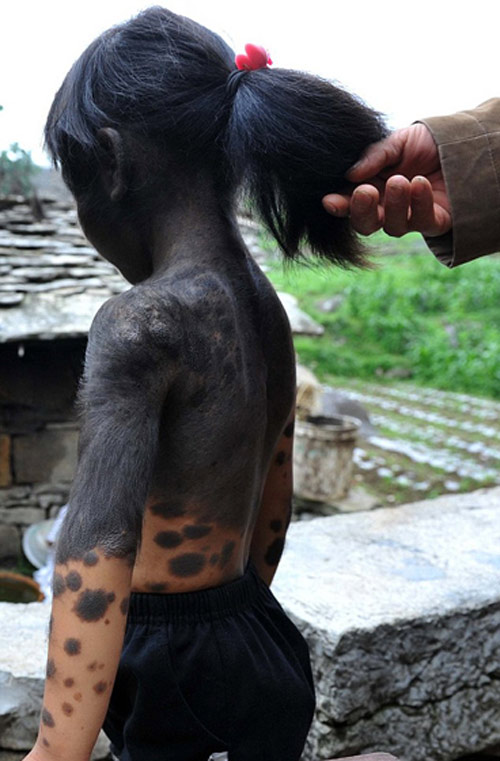 Những nụ cười đẹp nhất của nghị lực - 5