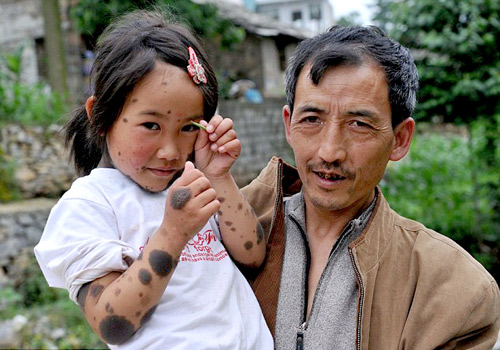 Những nụ cười đẹp nhất của nghị lực - 8