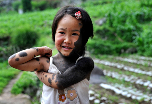 Những nụ cười đẹp nhất của nghị lực - 9