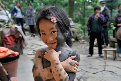 Những nụ cười đẹp nhất của nghị lực - 7