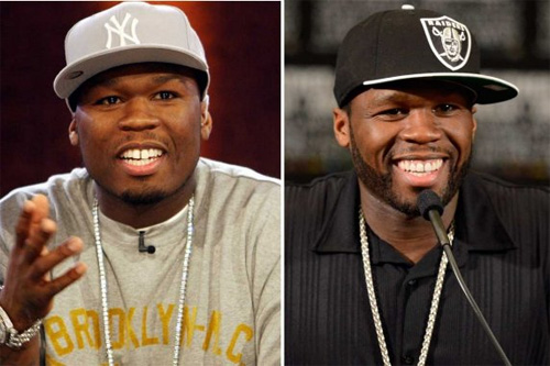 Lộ hàm răng xấu tệ của sao trước thẩm mỹ - 5