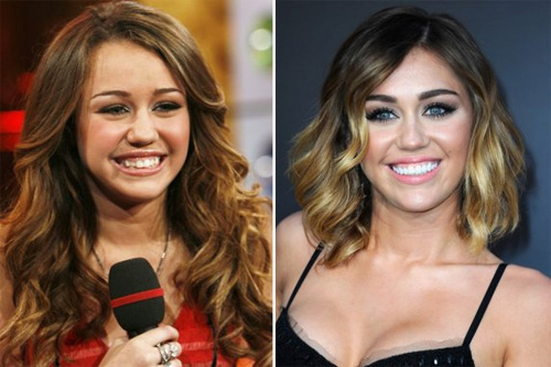 Lộ hàm răng xấu tệ của sao trước thẩm mỹ - 8