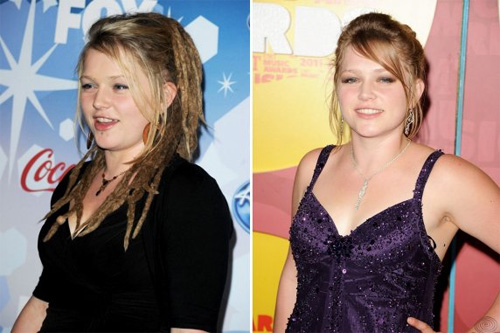 Lộ hàm răng xấu tệ của sao trước thẩm mỹ - 9