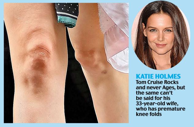 "Choáng" vì đầu gối củ lạc của siêu sao - 9