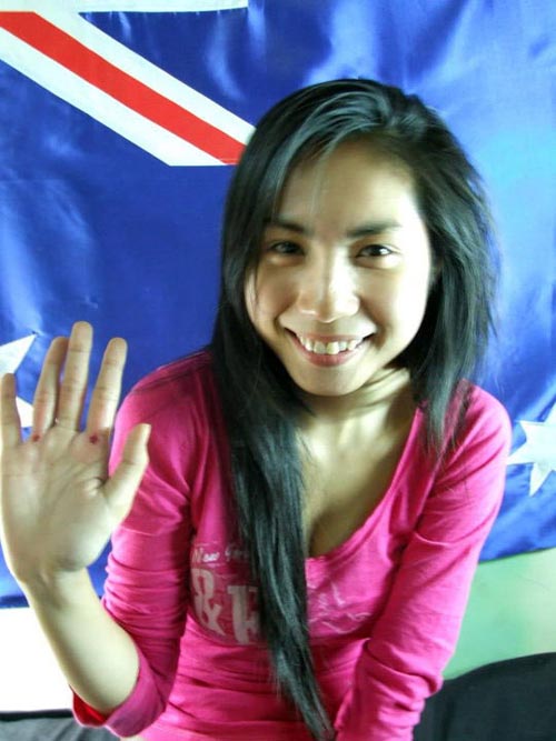 Giai nhân "lên đời" nhan sắc nhờ... răng - 14