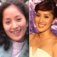 Bí quyết mặc đẹp - Giai nhân "lên đời" nhan sắc nhờ... răng