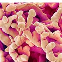 Sức khỏe đời sống - Sự thực về tục ăn nhau thai chính mình