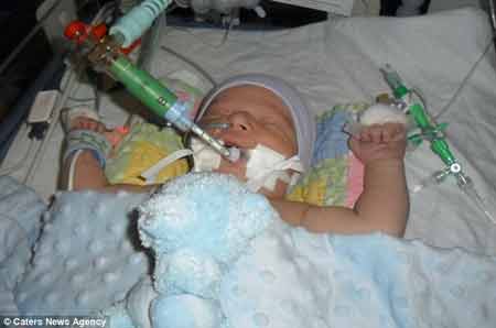 Cậu bé mắc 6 dị tật tim sống sót kì diệu - 2