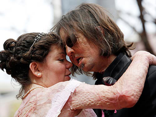 Người đàn ông không mặt cưới vợ - 2