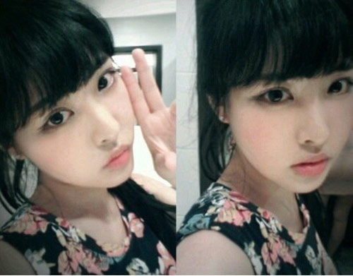 Gái Hàn "hóa thiên nga" nhờ dao kéo - 10