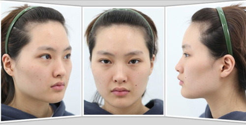 Gái Hàn "hóa thiên nga" nhờ dao kéo - 11