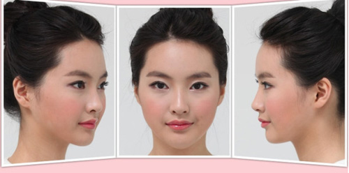 Gái Hàn "hóa thiên nga" nhờ dao kéo - 12