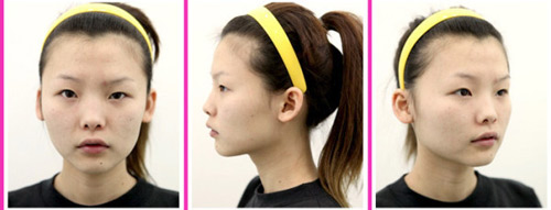 Gái Hàn "hóa thiên nga" nhờ dao kéo - 13