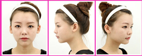 Gái Hàn "hóa thiên nga" nhờ dao kéo - 14