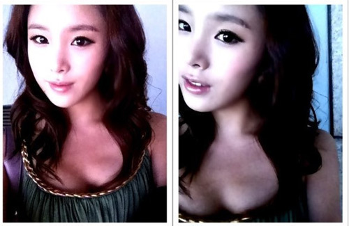 Gái Hàn "hóa thiên nga" nhờ dao kéo - 2