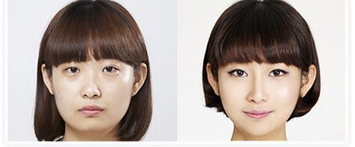 Gái Hàn "hóa thiên nga" nhờ dao kéo - 5