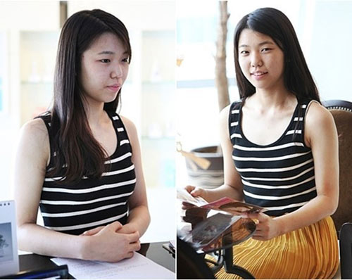 Gái Hàn "hóa thiên nga" nhờ dao kéo - 4