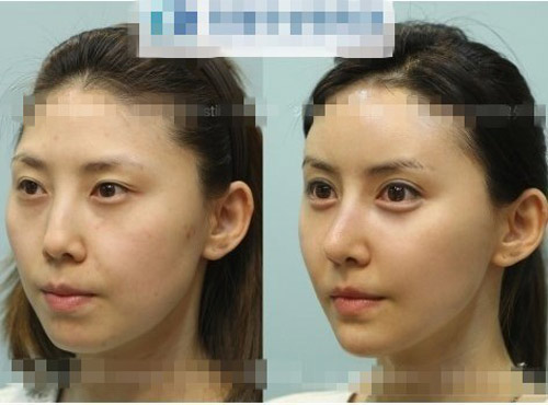 Gái Hàn "hóa thiên nga" nhờ dao kéo - 6