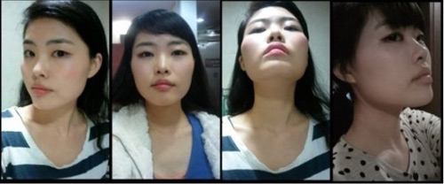 Gái Hàn "hóa thiên nga" nhờ dao kéo - 9